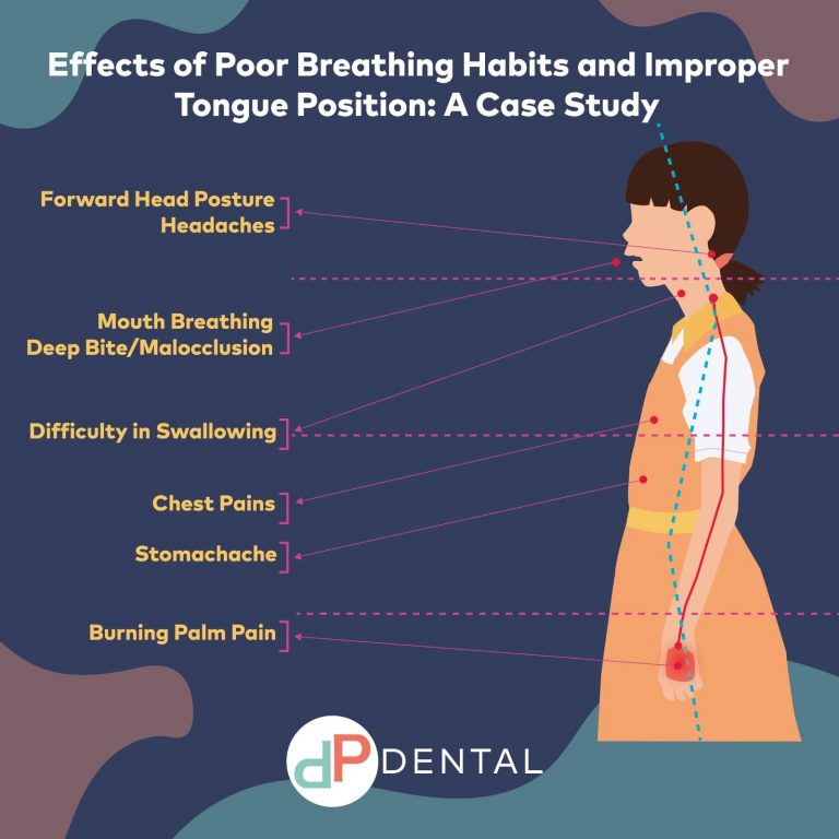 Effects of Poor Breathing Habits and Improper Tongue Position