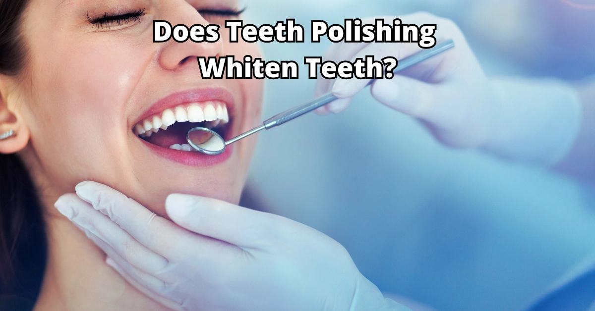 Teeth polishing