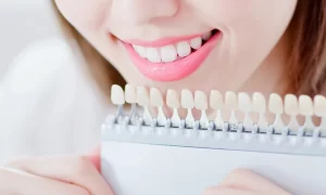 Benefits of Teeth Polishing