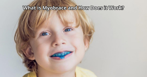 How Myobrace Treatment Works: A Guide To Natural Orthodontics