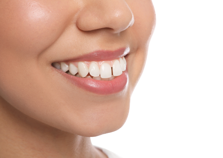 Can Invisalign Fix Overbite? Let’s Straighten the Facts