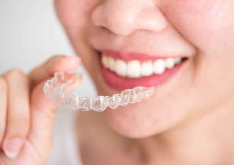 Invisalign vs. Braces: Which Is Faster