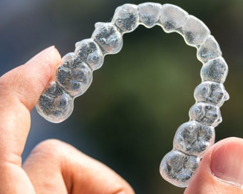 invisalign-first-benefits-3